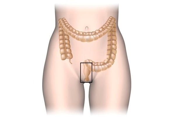 Common Causes of Rectal Pain