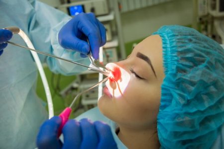 Surgical Treatment of Sinusitis Surgical Treatment of Sinusitis