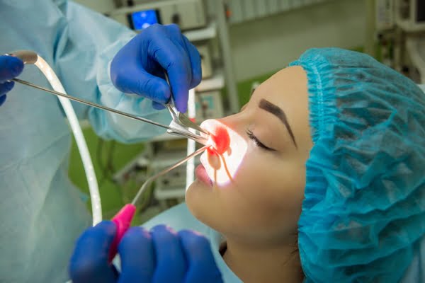 Surgical Treatment of Sinusitis