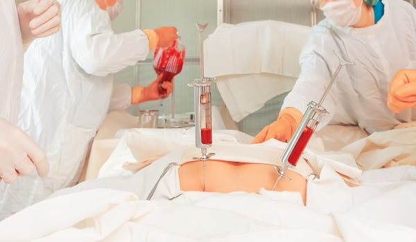 Osteomyelitis Surgery (Bone Infection Surgery)