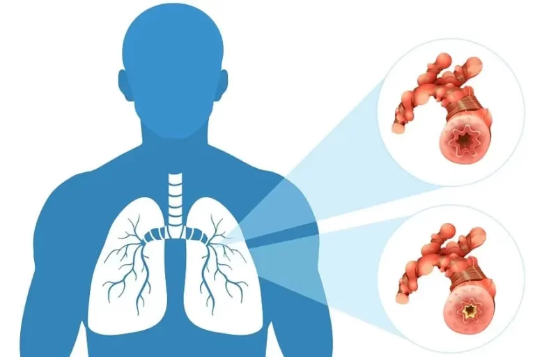 COPD Exacerbations