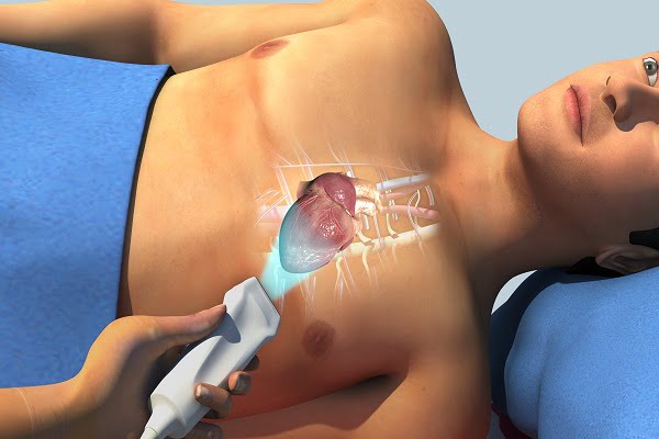 General Overview of Arrhythmia