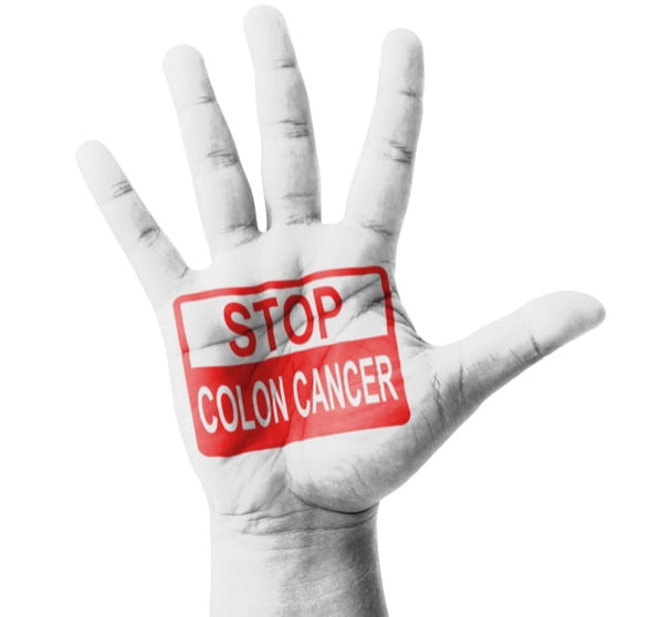 Prevention of Colorectal Cancer