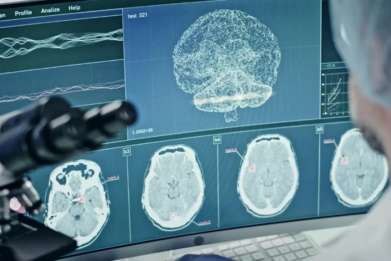 Pathophysiology of Epilepsy Pathophysiology of Epilepsy