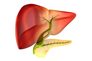 Gallstones without a gallbladder image