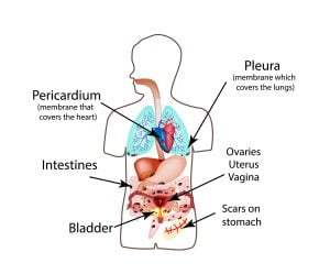 Areas in which endometrial tissue can appear