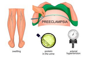 Symptoms of pre-eclampsia during pregnancy