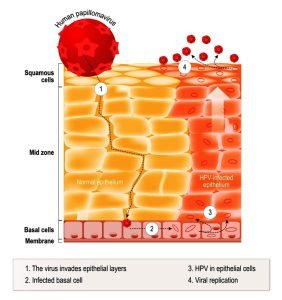 Life cycle of hpv in the human epithelium