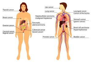 An image showing types of cancers