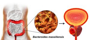 Gut microbiome and prostate cancer