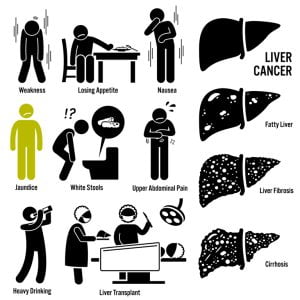 Liver cancer overview infographics