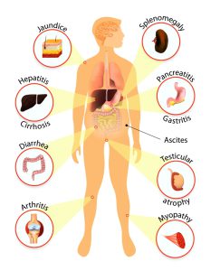 Symptoms of liver damage