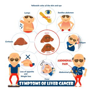 Liver cancer symptoms