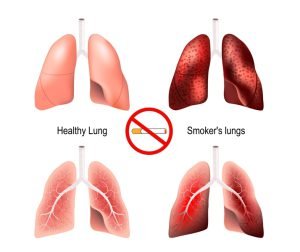 Health effects of tobacco