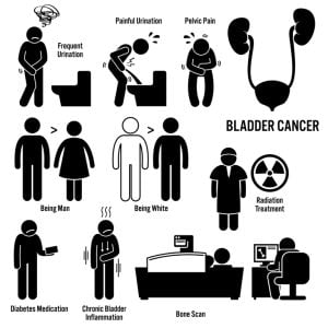 Bladder cancer overview - symptoms, risks, causes, treatment