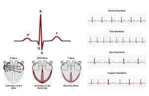Normal and abnormal heart beats