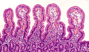 Microscopic view of small intestine with normal elongated villi