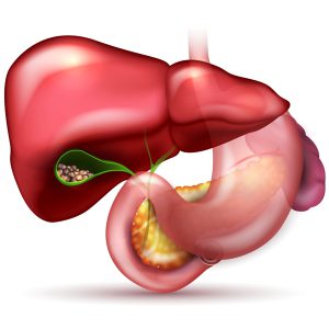 Gallstones 3D illustration