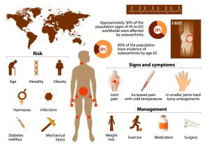 Osteoarthritis overview