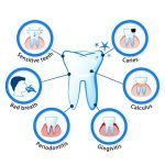 Common dental problems