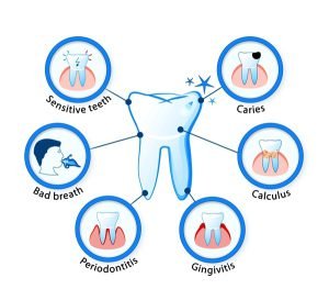 Common dental problems