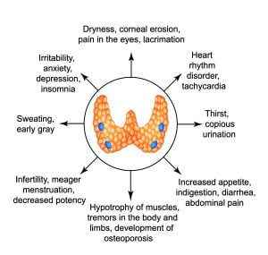 Symptoms of hyperthyroidism