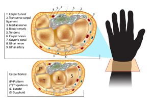 Wrist cross section