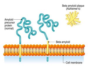 Mechanism of Alzheimer's- Amyloid-plaque formation