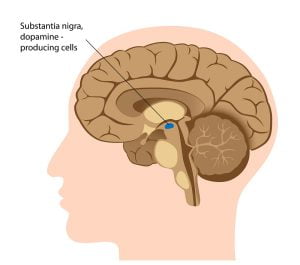 Damage site in Parkinson's disease