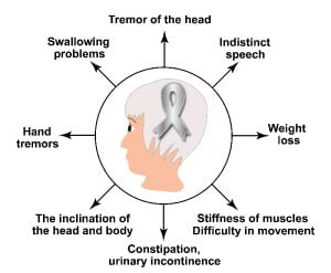 Symptoms of parkinson's disease