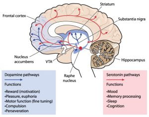 Parkinson's Disease - Effect on the brain