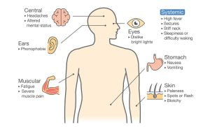 Symptoms of meningitis