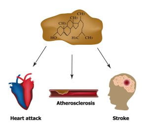 Cholesterol Levels