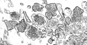 Transmission electron micrograph (TEM) depicting a number of Nipah