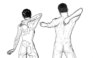 Pain due to sciatica