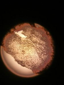 Skin dandruff viewed through a microscope