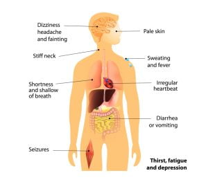 Hypotension signs and symptoms