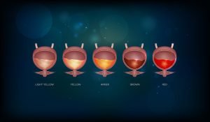 Urethritis can cause blood in urine