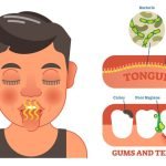 What is bad breath?