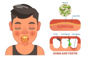 What is bad breath?