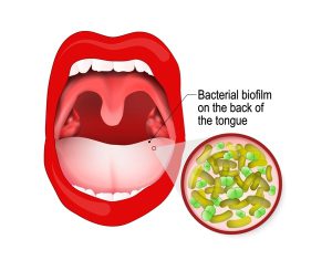 Bad breath and dry mouth