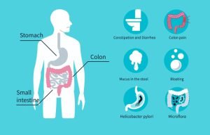 Irritable bowel syndrome (IBS) symptoms