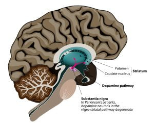 Human brain