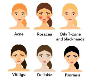 Common skin diseases