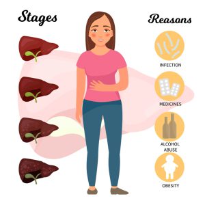 Stages and causes of cirrhosis of the liver