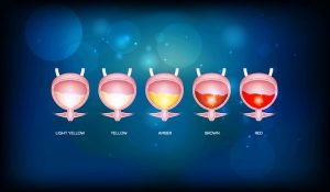 Urinary bladder and various urine colors from light yellow till red