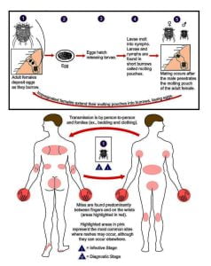 Life cycle of Sarcoptes scabei, the causal agent of Scabies