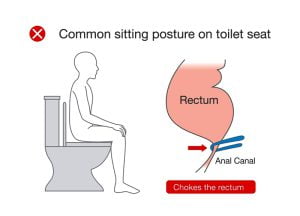 Common but wrong posture while sitting on toilet seat