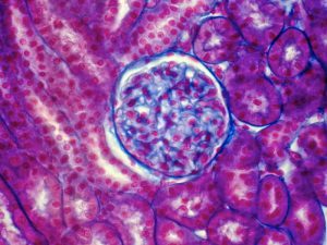Histology of human kidney, renal corpuscules and tubules