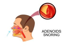 Snoring: A common reason of teeth grinding